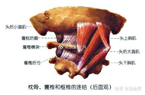 颅椎关节有两个颅椎关节①寰枕关节位于寰椎和枕骨之间②寰枢关节位于