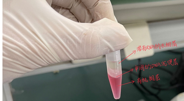 超详细lncRNA的提取方法——总RNA的提取 - 知乎