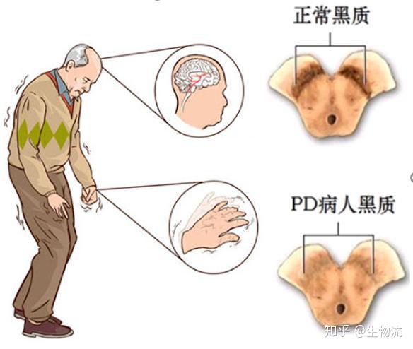 中脑黑质多巴胺图片