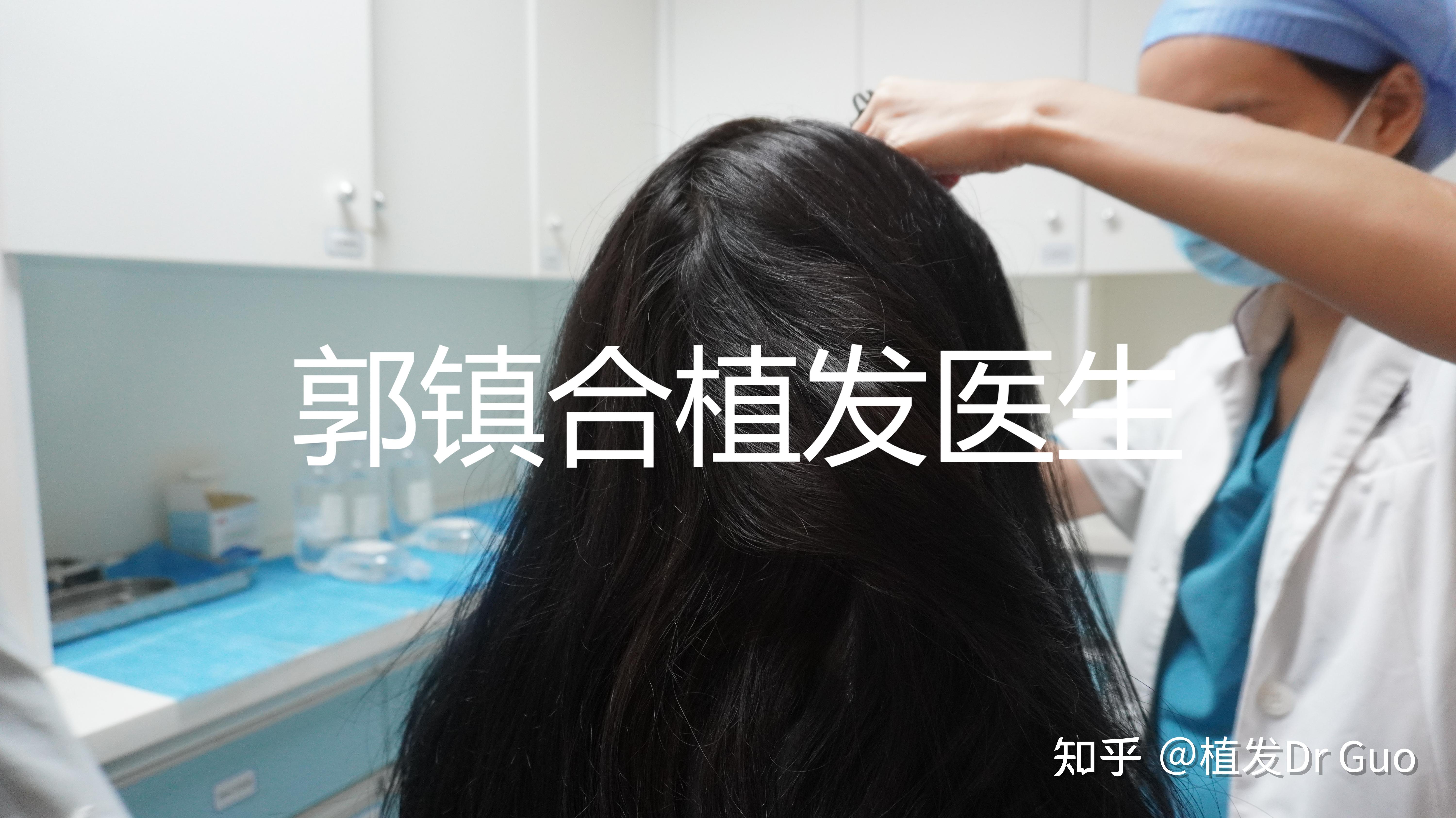 植发必须要自己做吗知乎(植发必须要自己做吗知乎推荐)