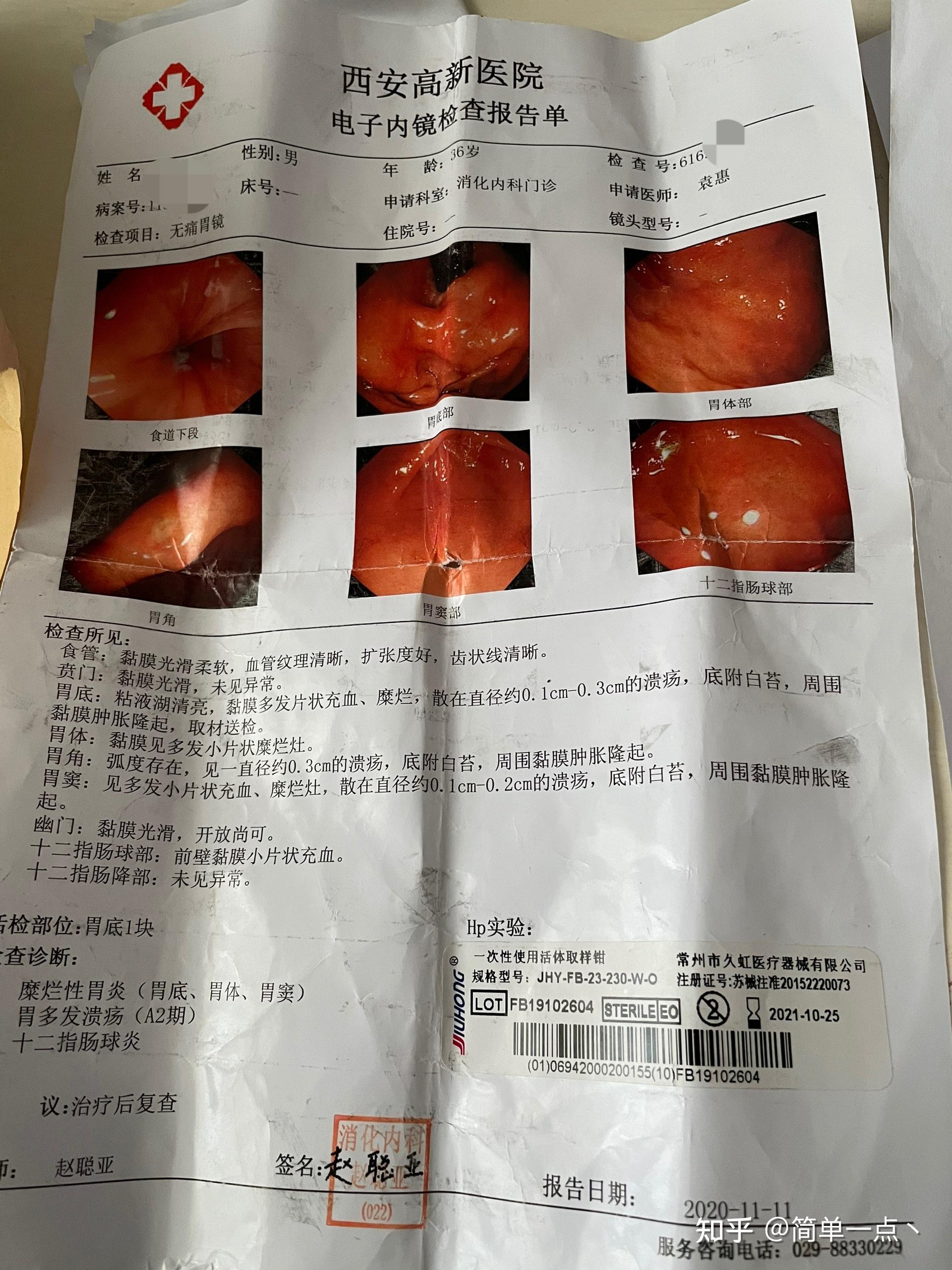 胃溃疡检测报告图片图片