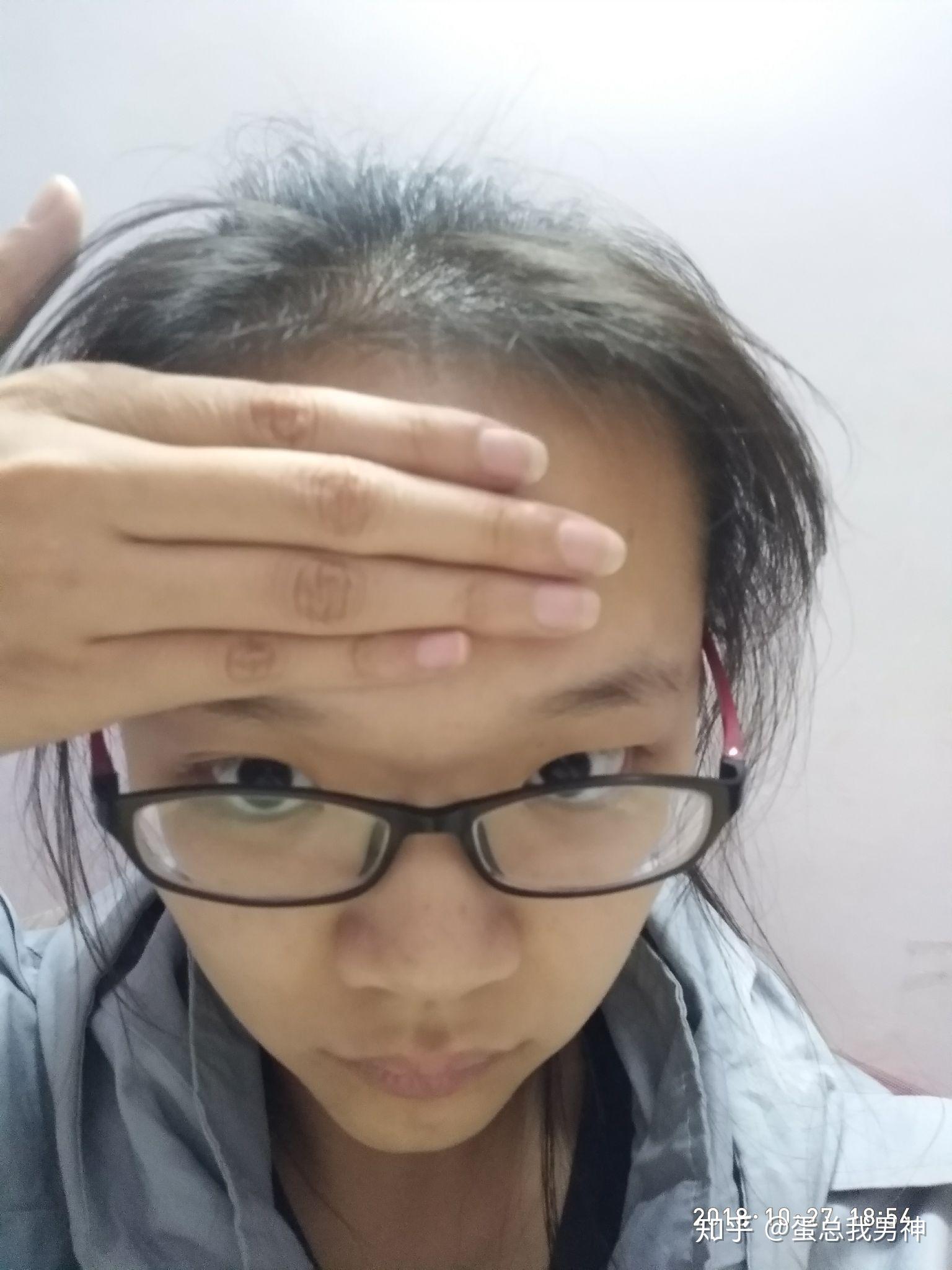 女生发际线高头顶平小脸个子娇小适合什么发型怎么打扮好