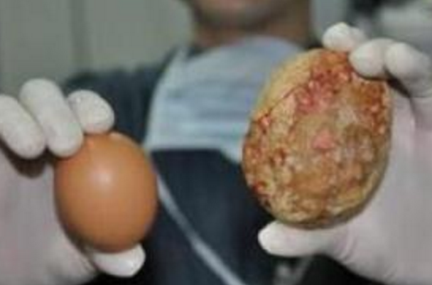 v2-b95c49806c1cf9b2a02b114fac070166_1440w.jpg?source=172ae18b