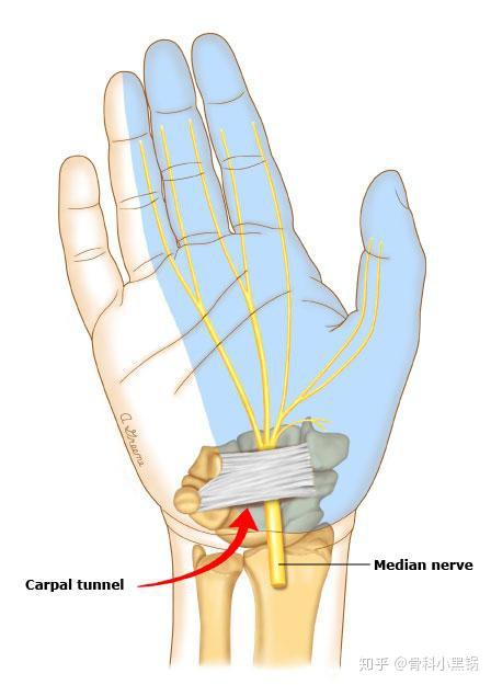 腕关节腱鞘炎解剖图图片