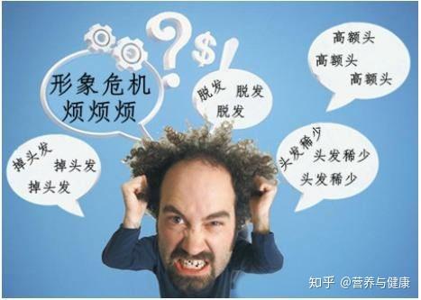 脱发年龄提前了10年今年你被脱发困扰了吗