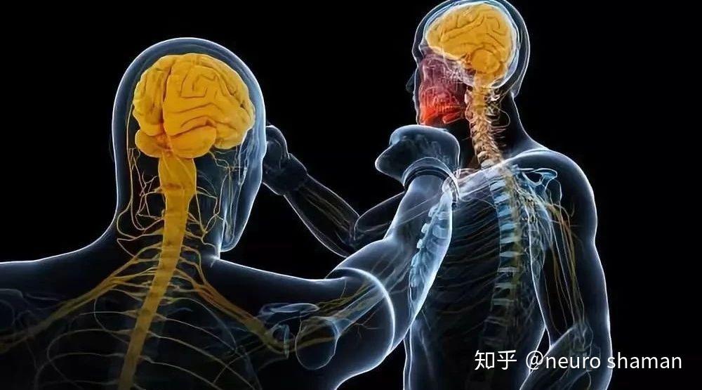 去皮层僵直是什么,去皮层僵直与去大脑僵直有什么区别? - 知乎