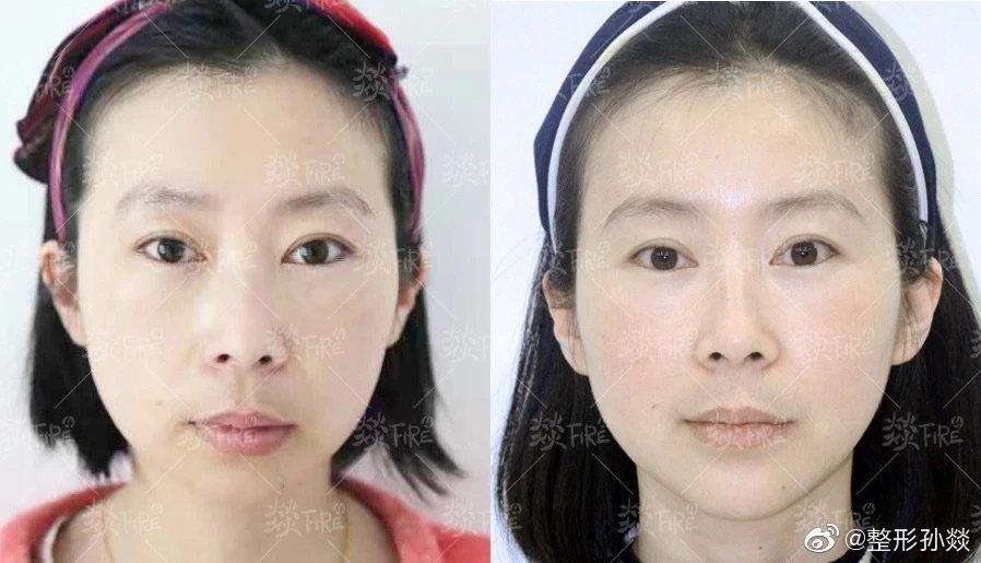 唉 丨又一个姑娘问我 我骨相不好怎么办 知乎