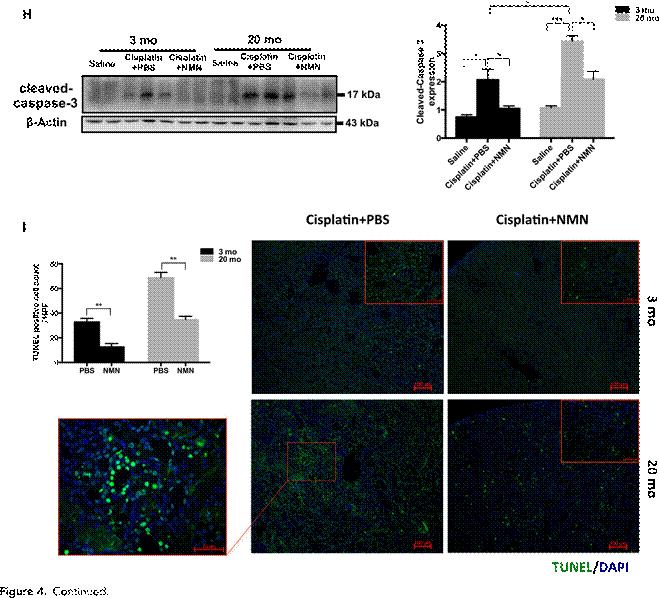 nmn烟酰胺单核苷酸挽救老年人对aki的易感性sirtu1依赖方式