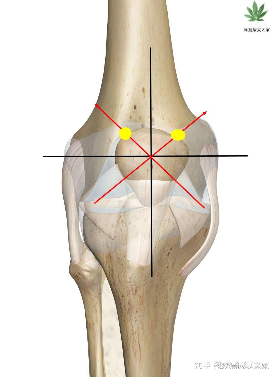 膝关节穿刺点定位图图片