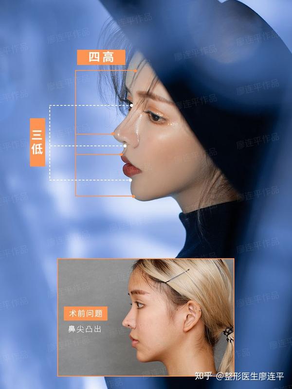 鼻子审美(六)-鼻部与面部的美学关系 - 知乎