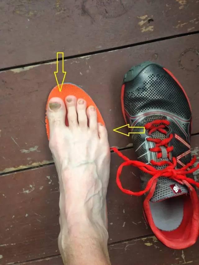toe hitting top of shoe
