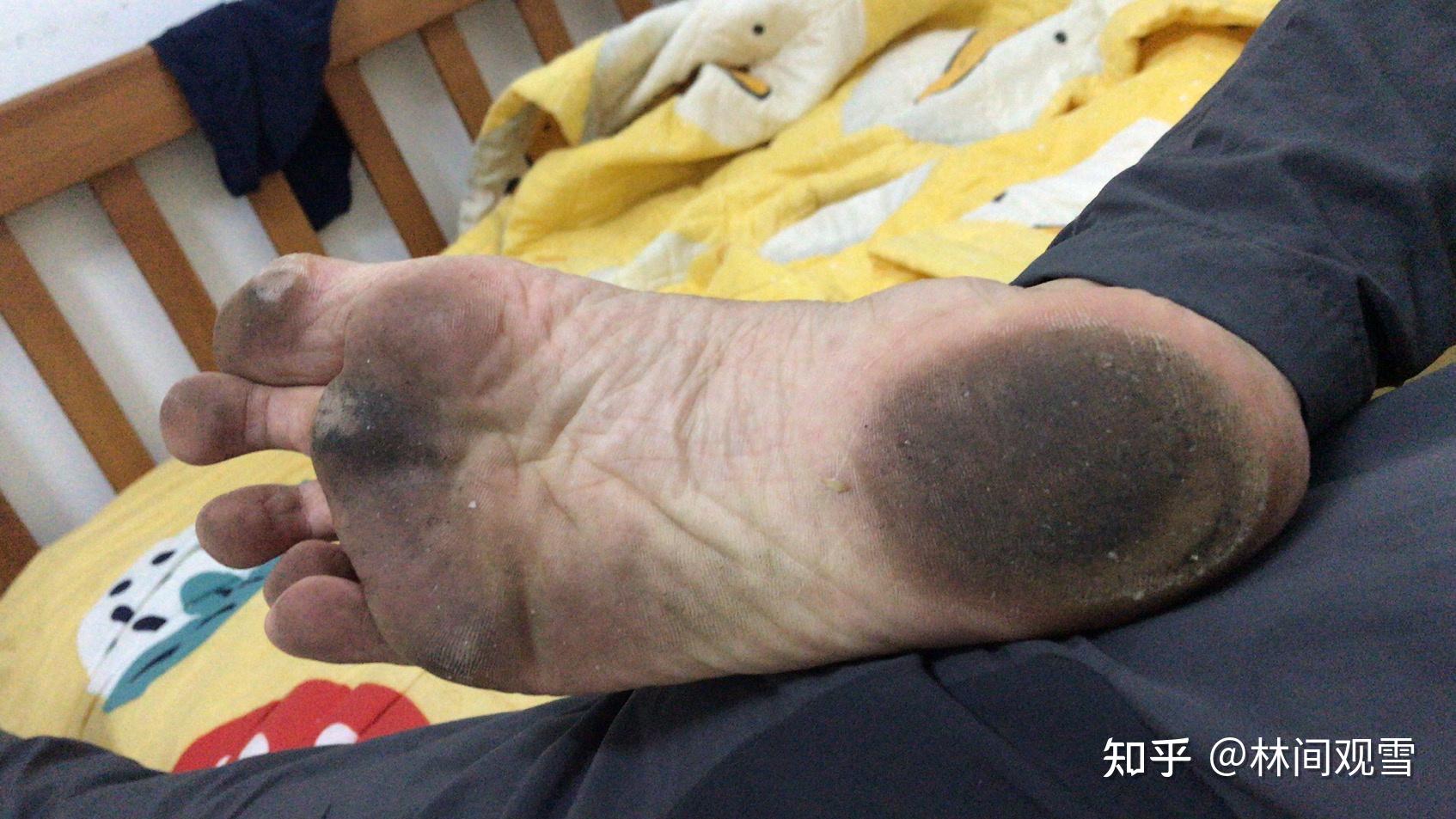 怎么才算好看的脚底呢