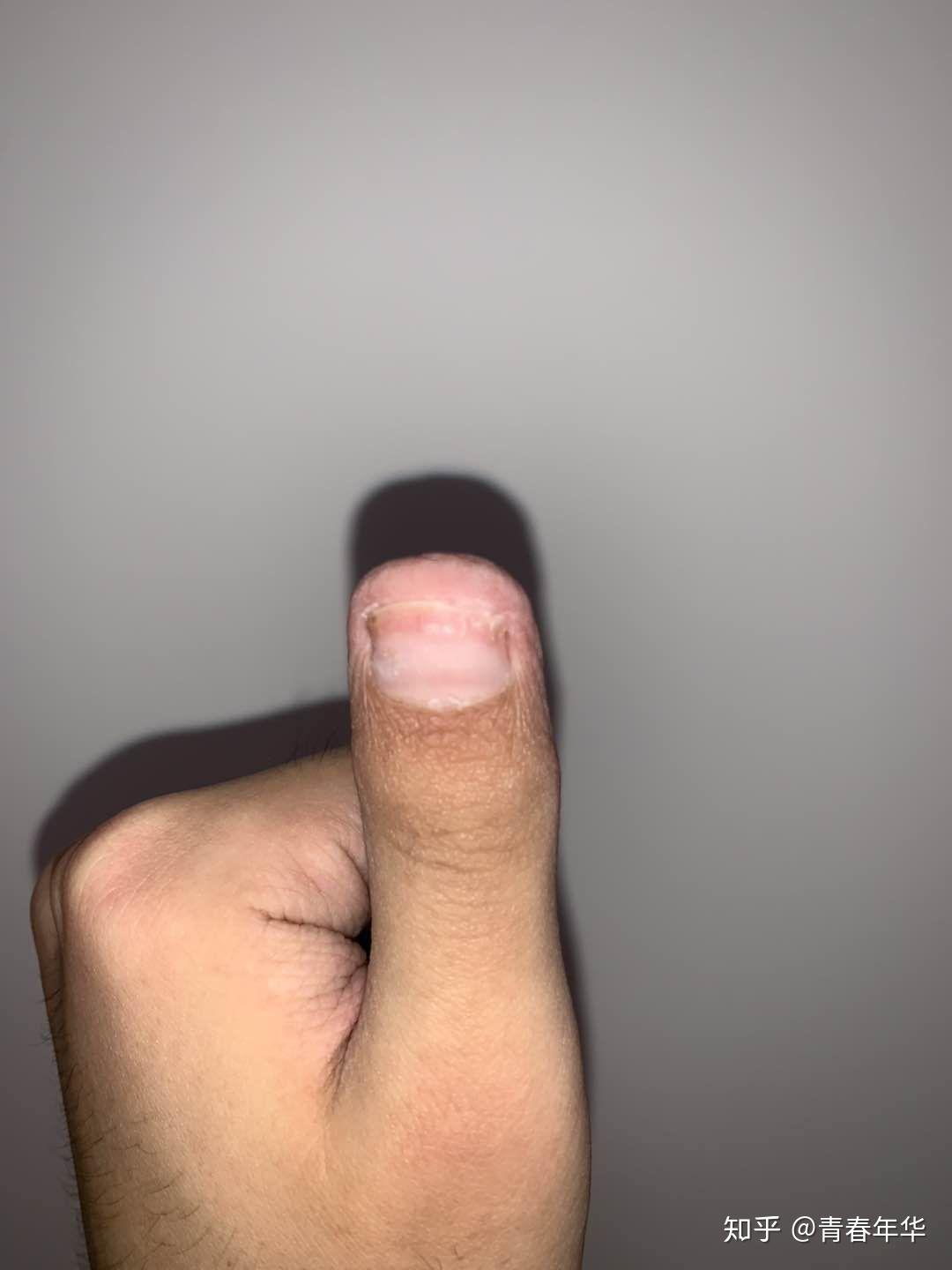 为什么大拇指又短又宽? - 知乎