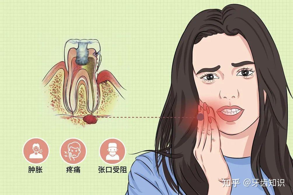 智齿牙发炎有哪些炎症呢 