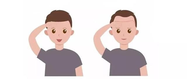 这种情况属于m字脱发吗,最近感觉发际线越来越高?