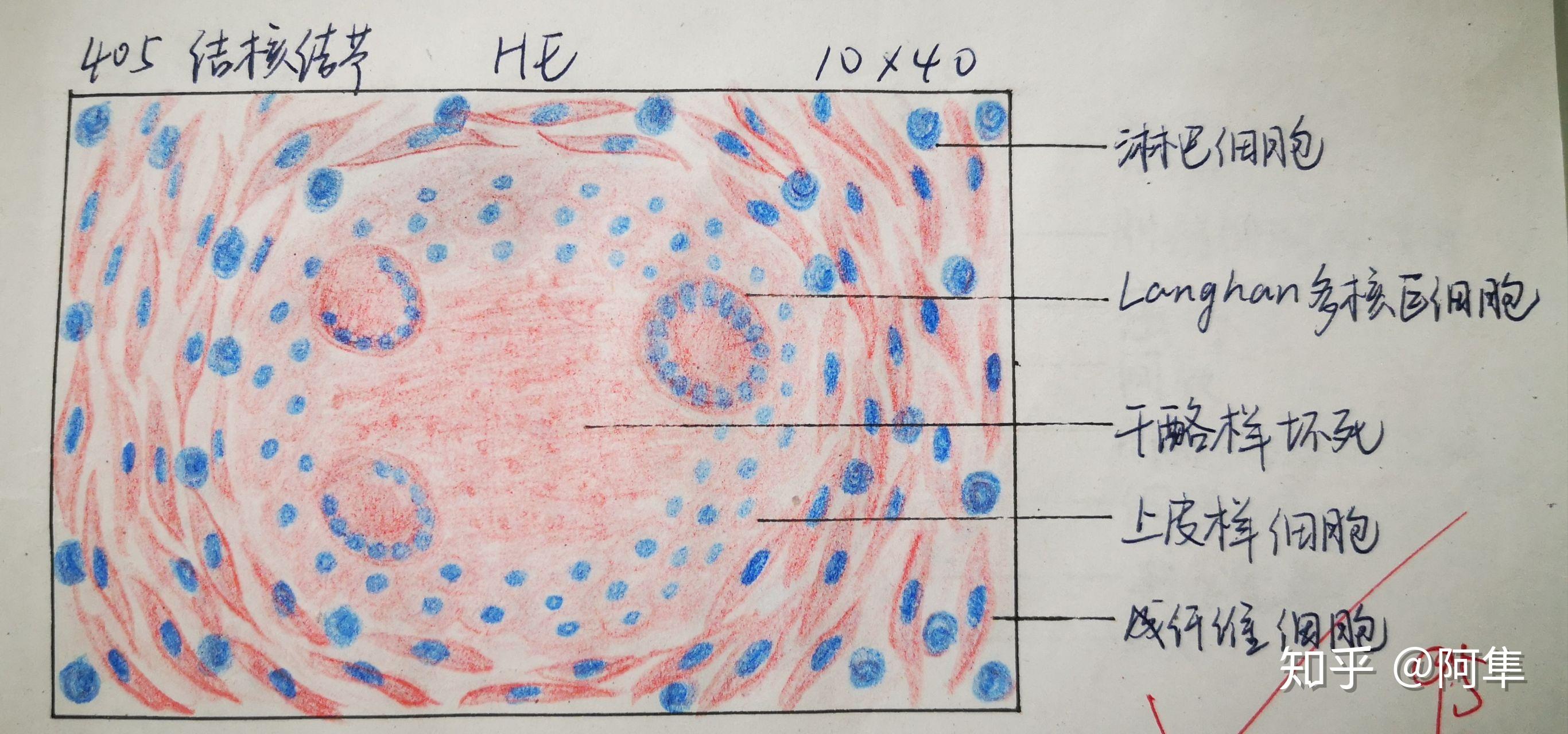 为什么咱们不弄个病理红蓝手绘图的问题呢?