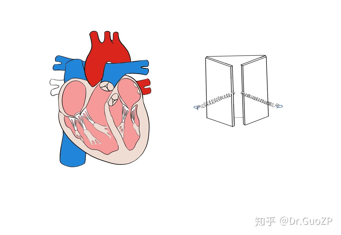 二尖瓣狭窄动画图片