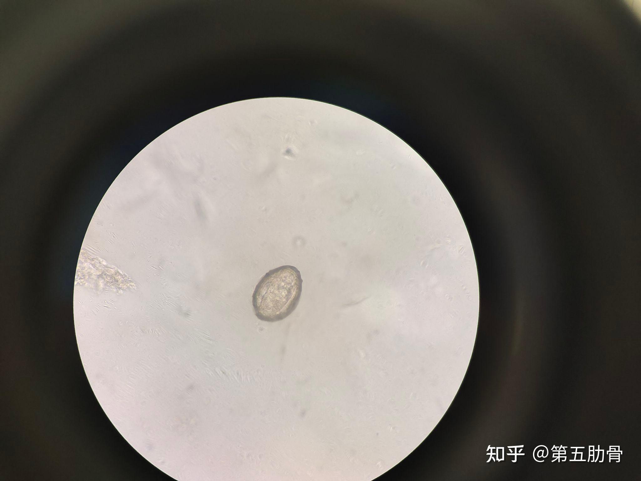 医学寄生虫学镜下实拍 知乎
