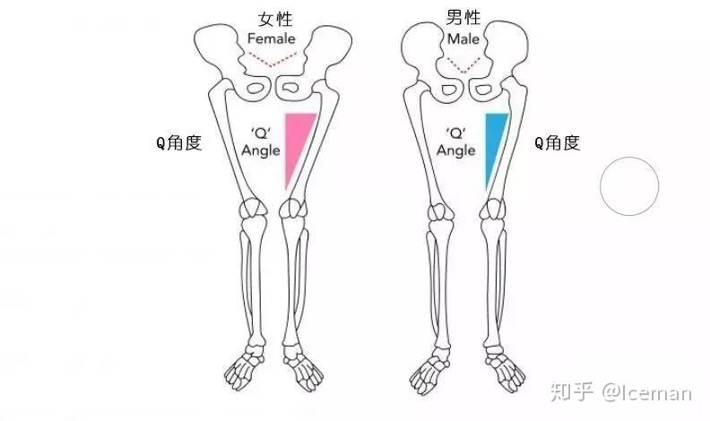 要先了解一個概念——q角度,q是股四頭肌的英文quadriceps的縮寫