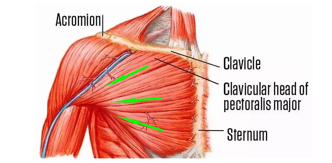 中胸的肌纖維是從胸骨——胸部正中間的這一塊骨頭,以一種更加水平
