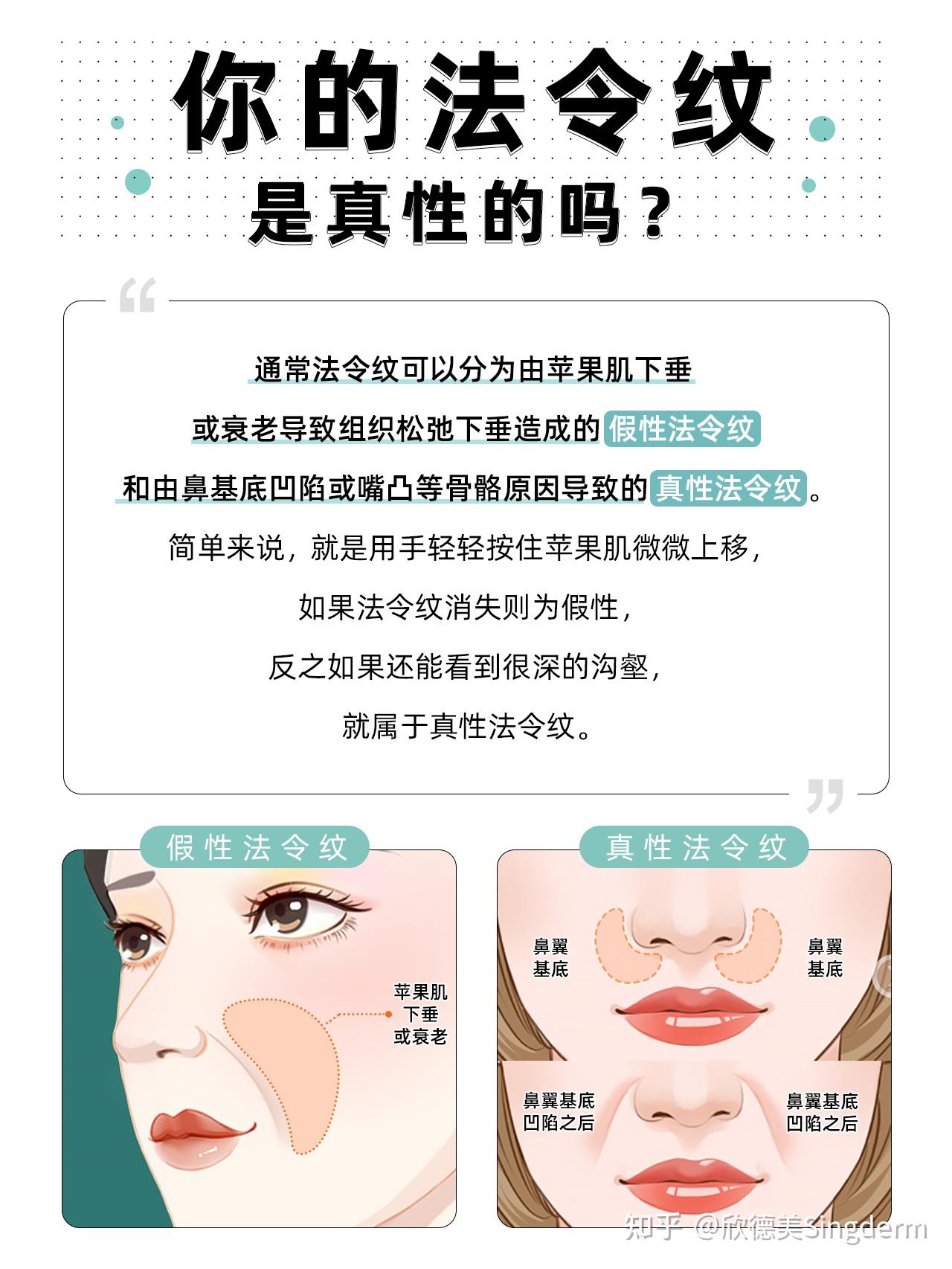 你的法令纹是真性的吗? - 知乎