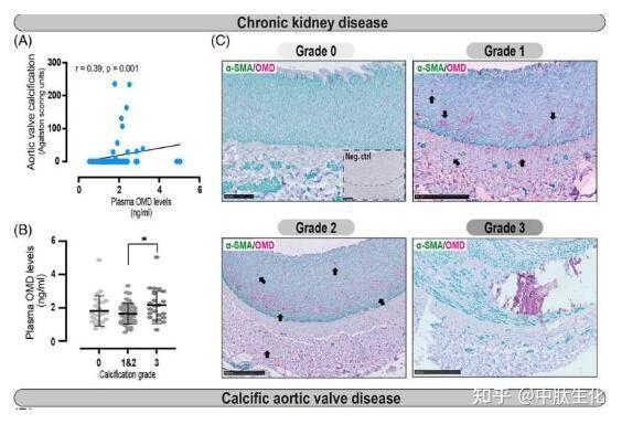 ctm骨調蛋白或能作為機體血管鈣化的一種新型生物標誌物