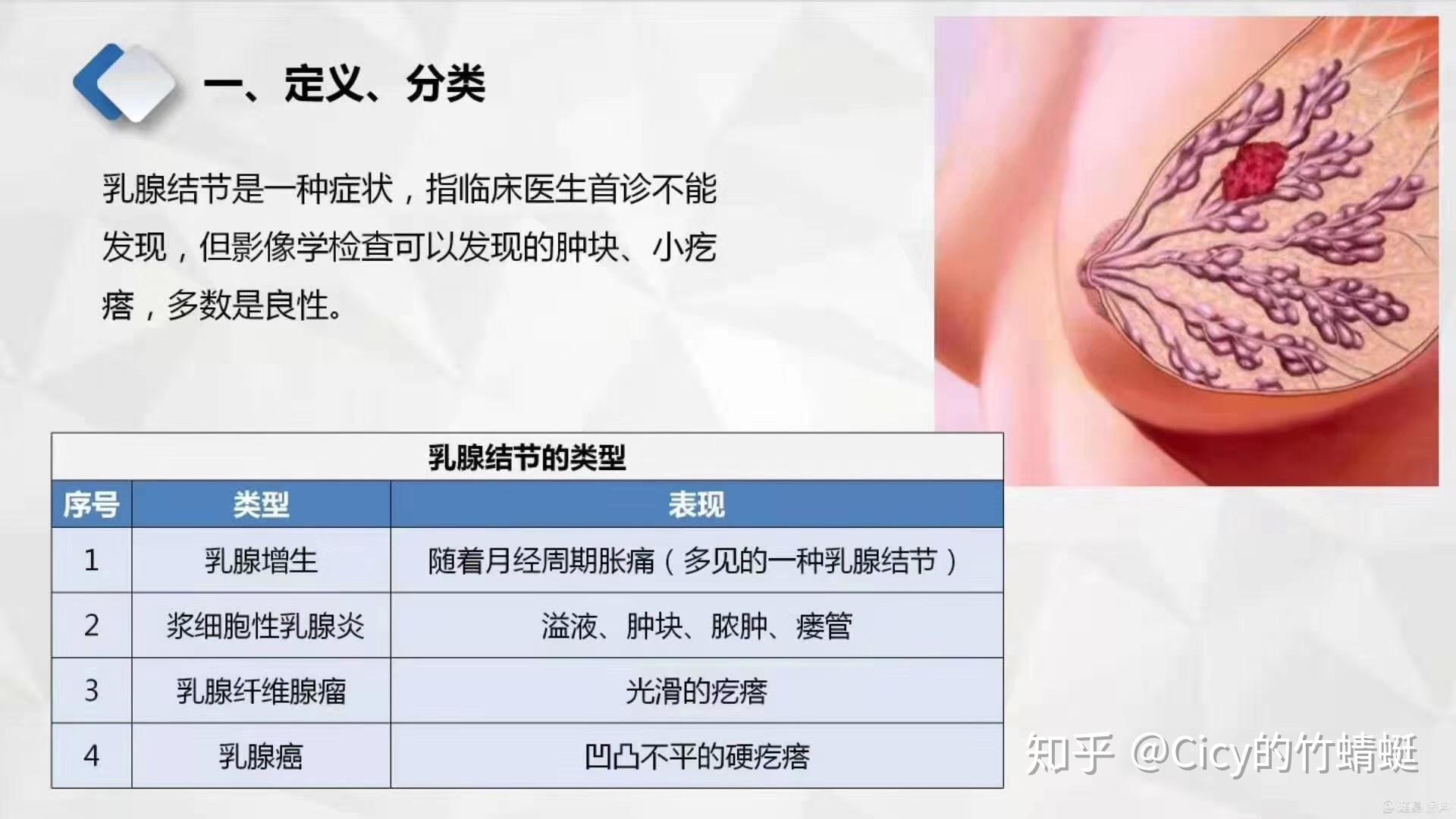 乳腺结节三级什么意思图片