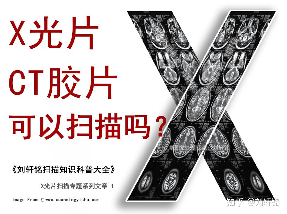 X光片和CT胶片可以扫描吗? - 知乎
