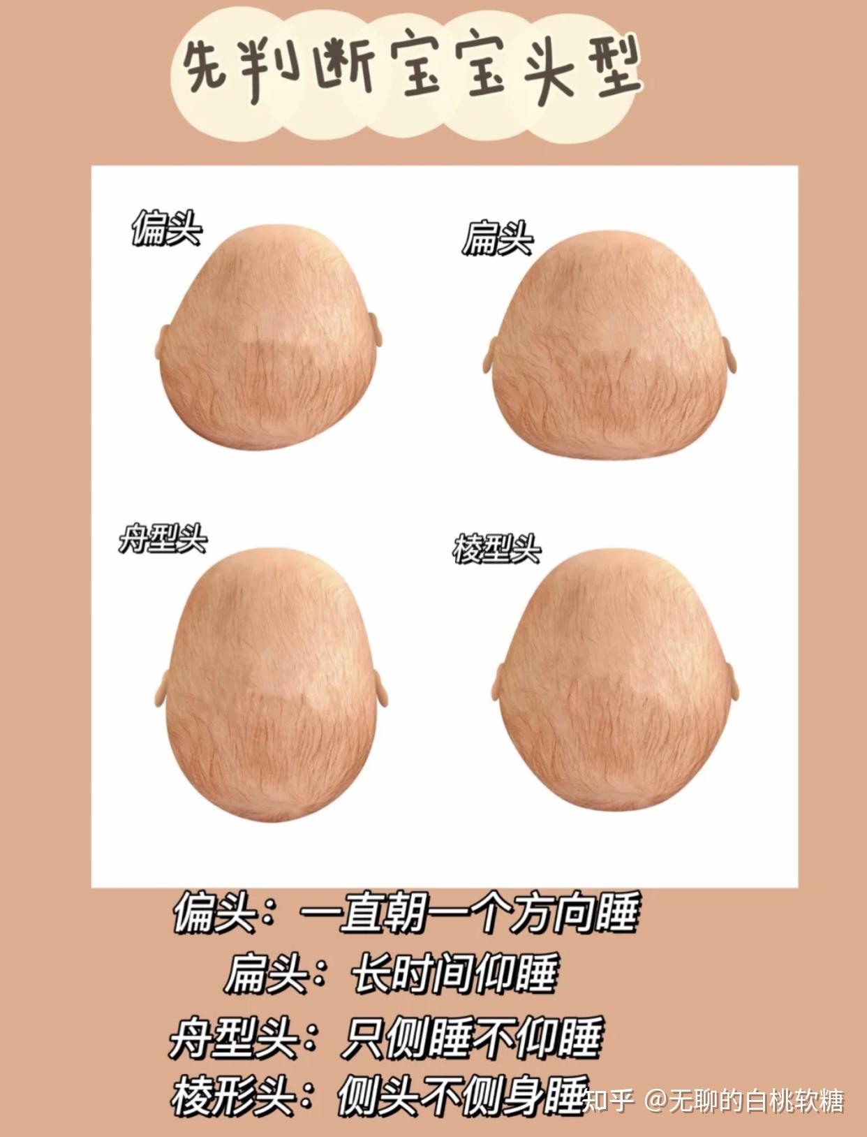 4个月的宝宝头型怎么调整? - 知乎