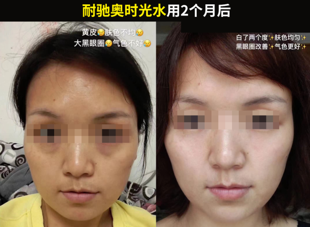脸上面部细纹太多怎样能消除?什么成分可以淡化细纹?(美容院) - 知乎