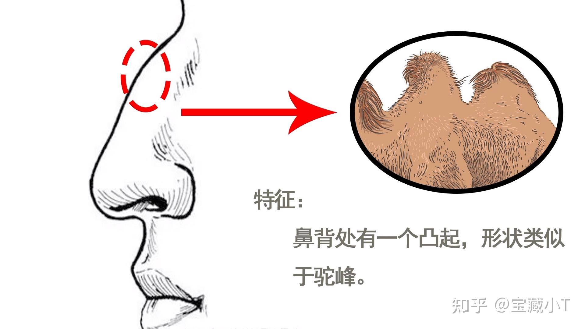五大常见鼻型,你属于哪一种? - 知乎