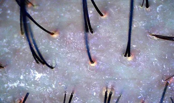 医院里的毛囊检测是什么样子的? - 知乎