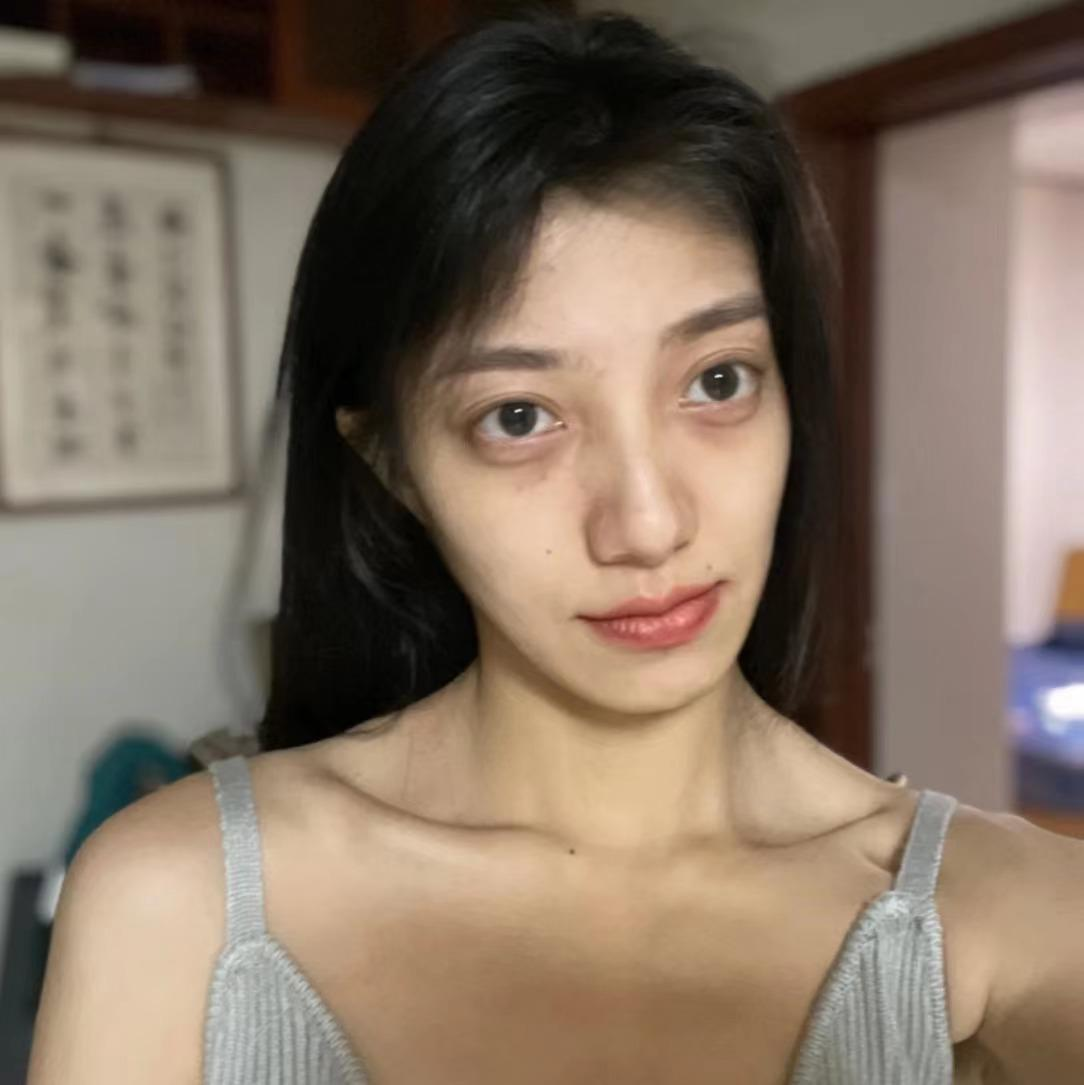 黑眼圈特别严重怎么办常年黑眼圈不消怎么去掉学生党怎么去黑眼圈眼霜