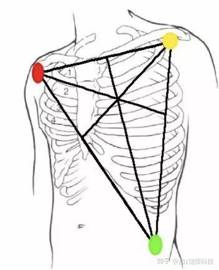 心电图检测胸前导联电极说明