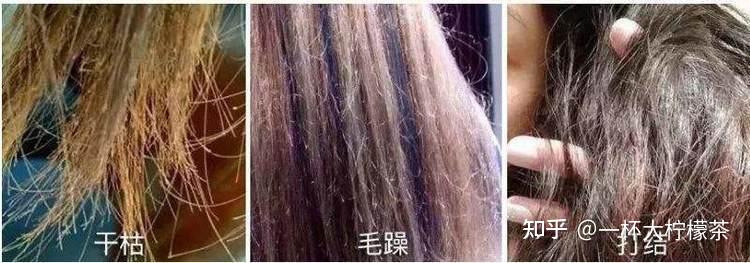 发质差、发量少？这4个错误大多数人会犯，Meinde提示你用生物素护发有诀窍 - 知乎