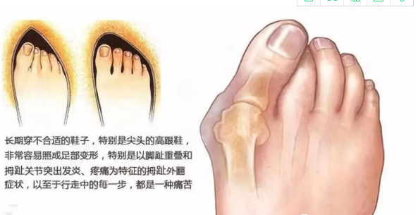 v2-bc70020d33a92541c922d348f3b2b8a9_1440w.jpg?source=172ae18b
