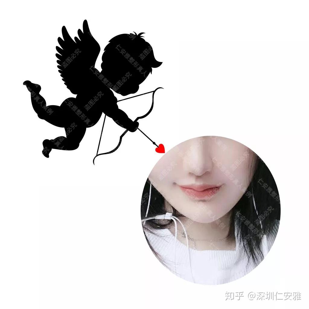 丘比特弓唇特点:上唇下缘呈弓形,有唇珠!