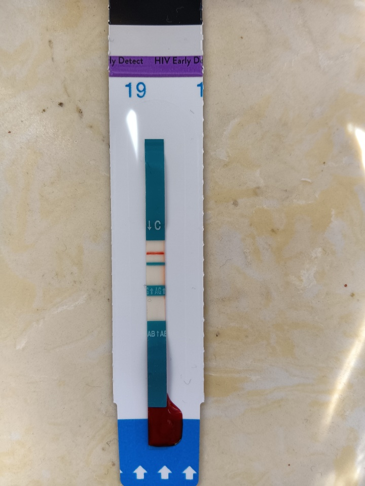 雅培和爱威康hiv试纸? - 知乎