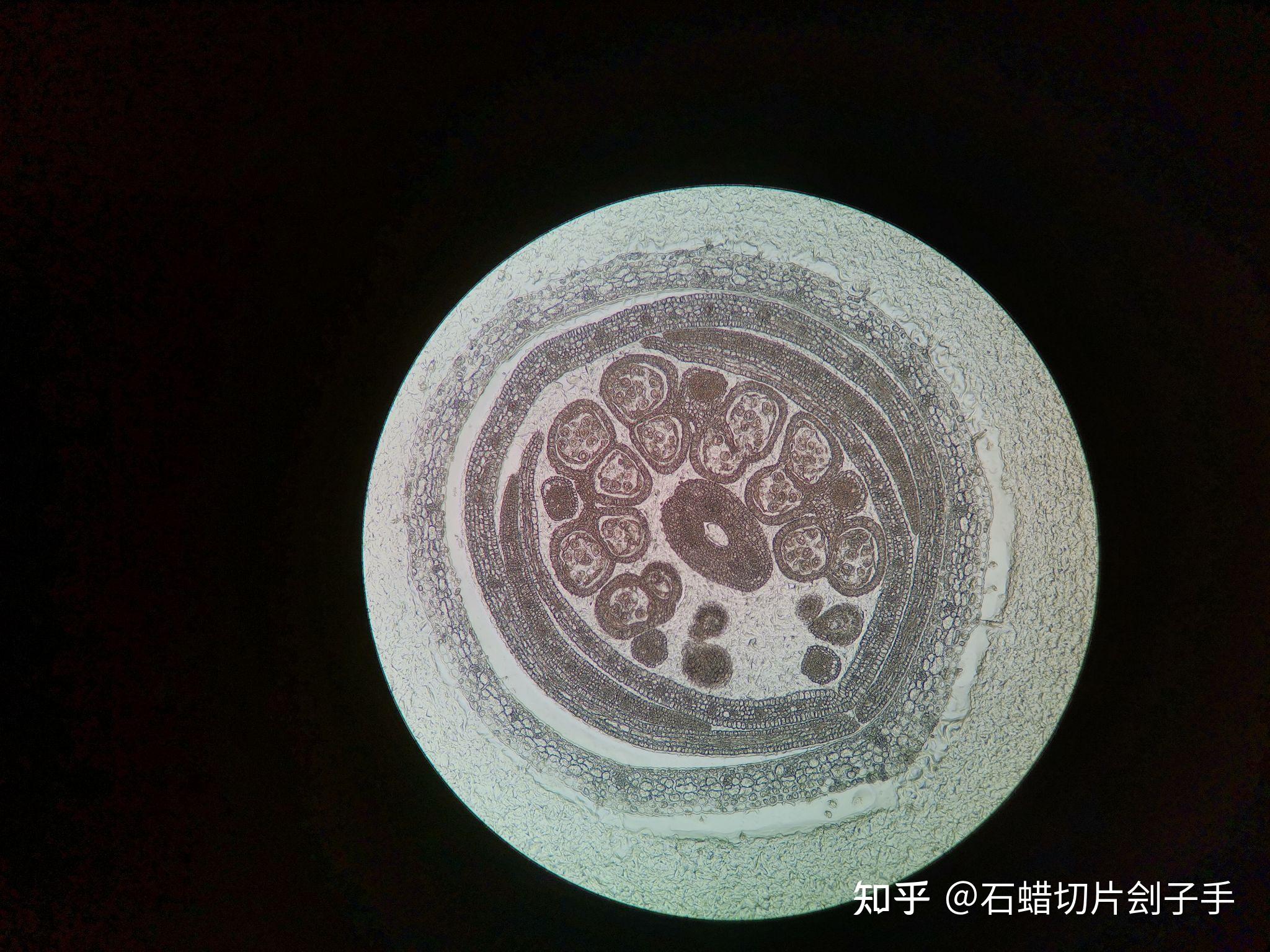 盘点我经手的石蜡切片 - 知乎