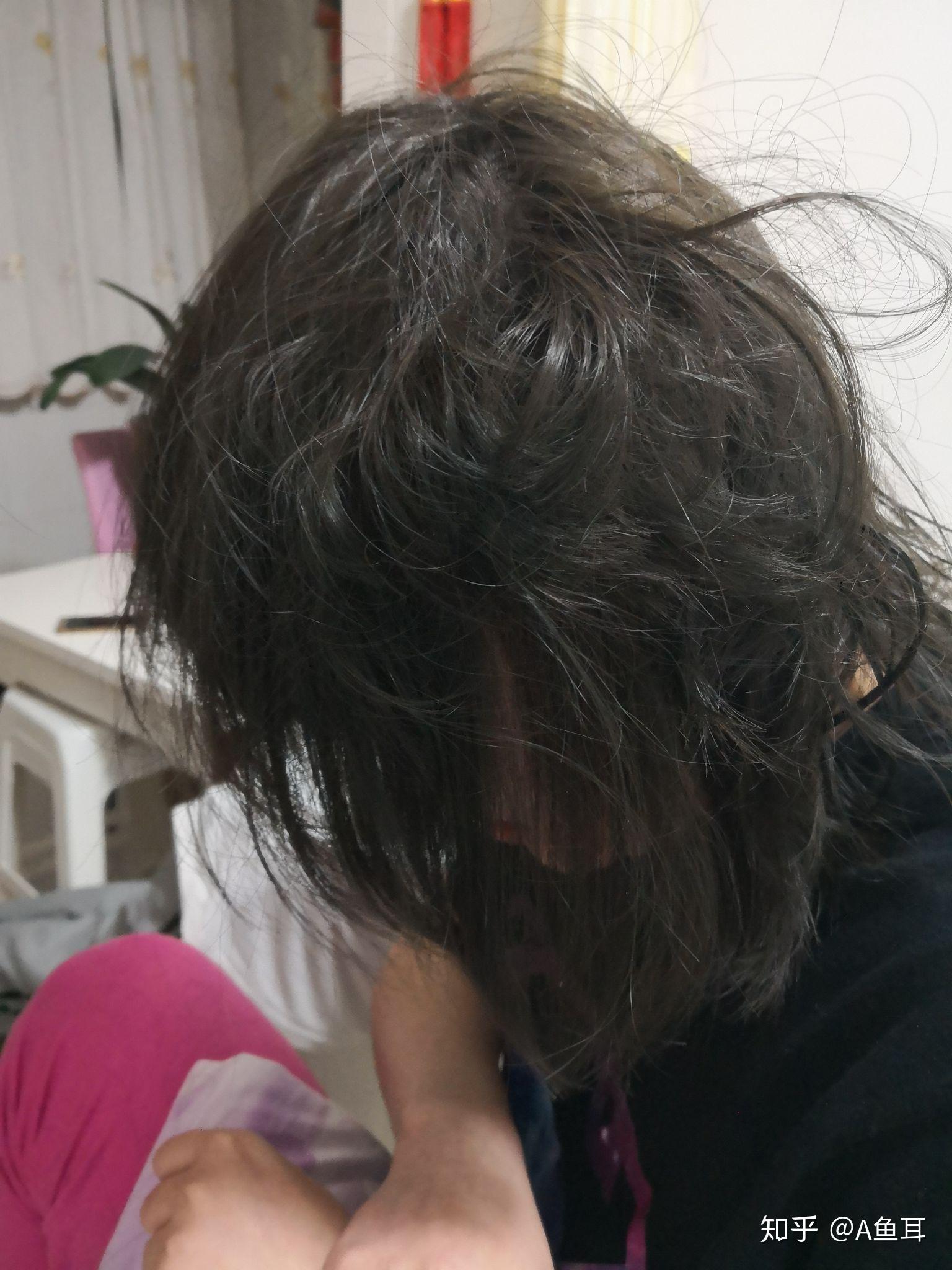 卷梳卡死在头发上怎么解决