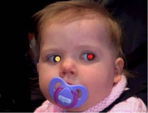 5岁娃近视1000度!罪魁祸首,不是手机,是「远视储备」!