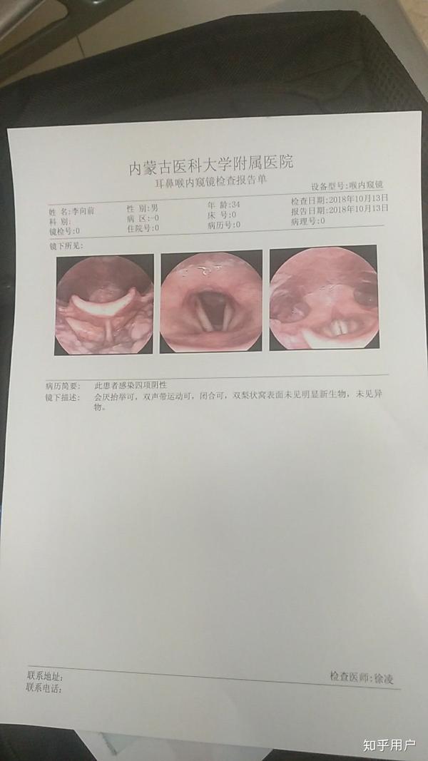 喉镜正常图片图片