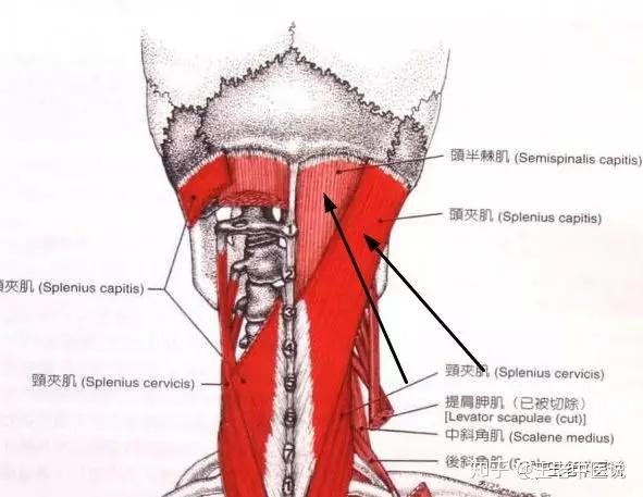 簡單易學自我拉伸保養頸椎之三頭夾肌與頸夾肌的自我拉伸