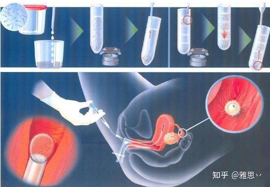 白酒对男人性功能有影响吗,白酒对精子有影响吗 白酒对男人性功能有影响吗,白酒对精子有影响吗
