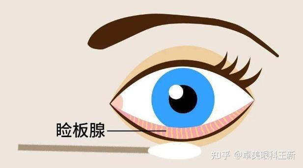 1分钟读懂干眼检查 - 知乎