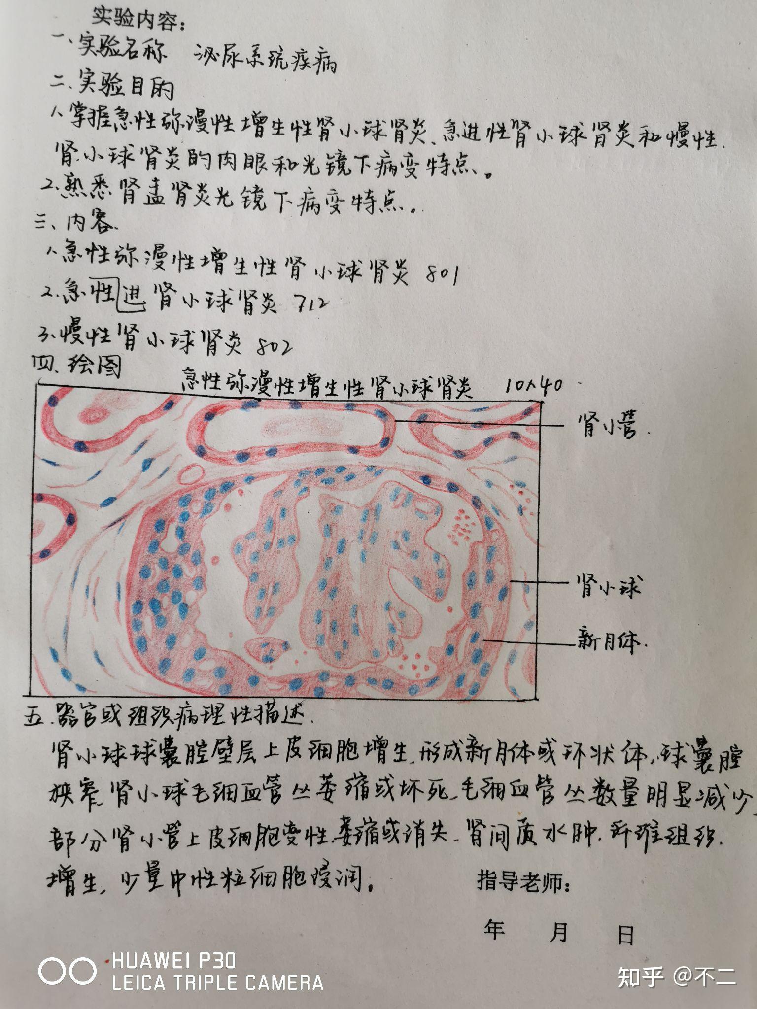 肾组胚红蓝铅笔绘图图片