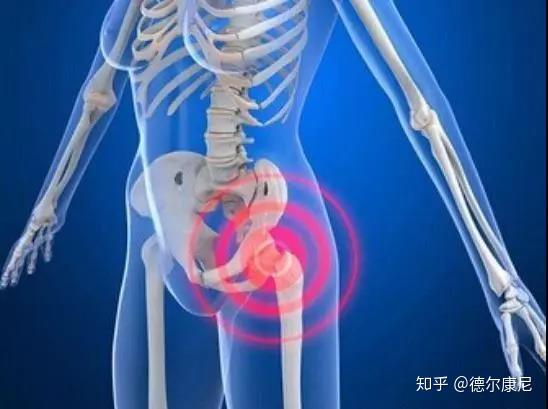 如何正常测量股骨全长 v2-bdda32074a703fead5dad9a3c4d62c70_r.jpg