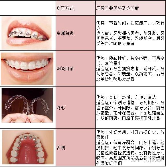 隐适美牙套大概多少钱?隐形矫正与传统矫正有哪些区别?