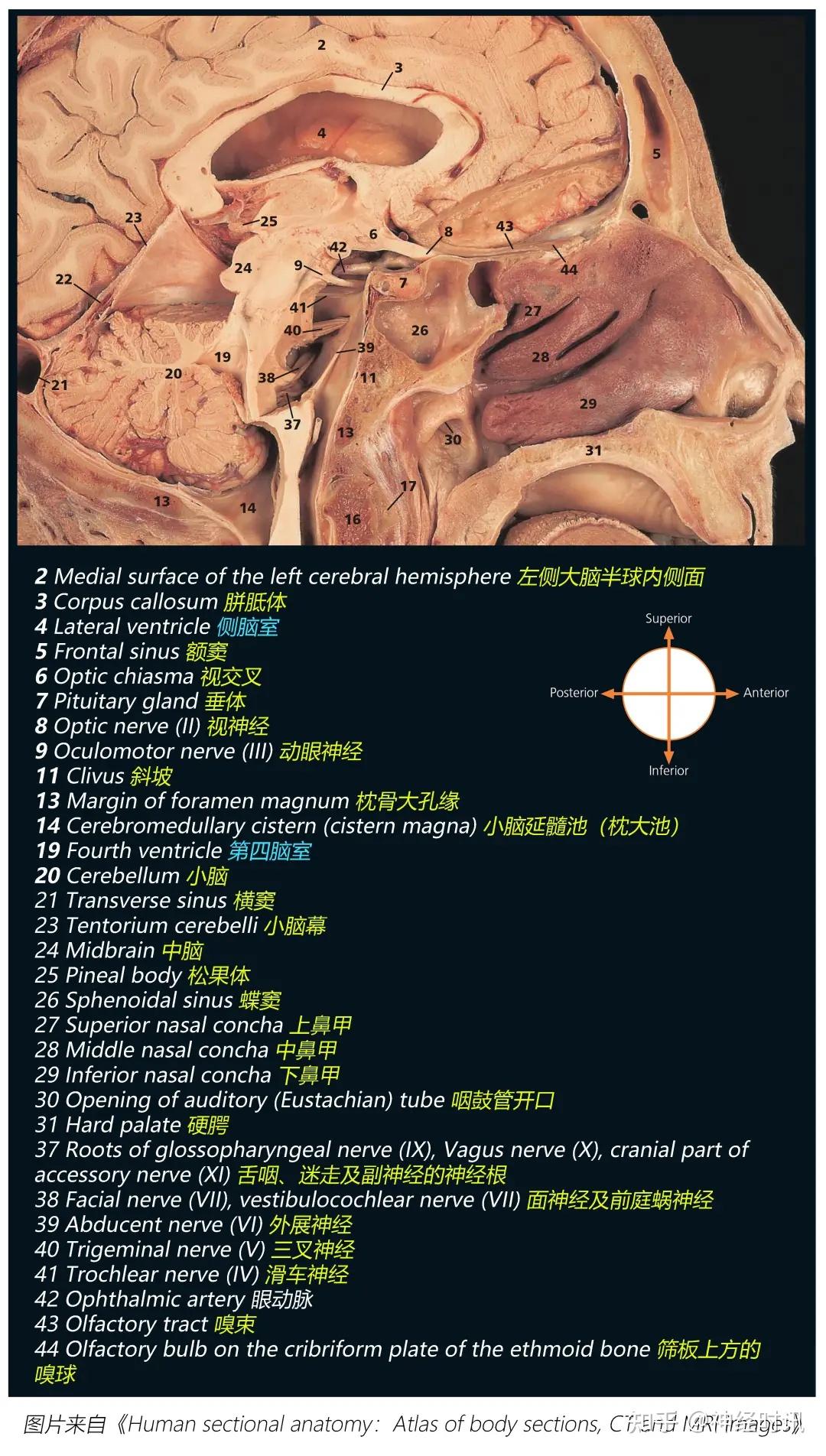 高清图谱 | 出入脑干的10对颅神经走行图解 - 知乎