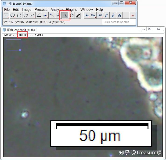 ImageJ实用技巧——比例尺设置和批量添加(基本功能篇) 知乎